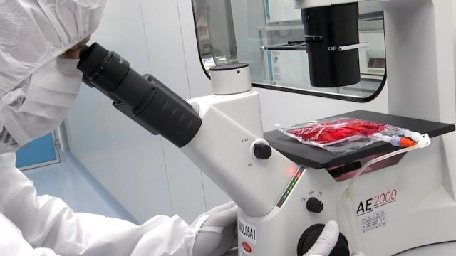 Nuove applicazioni della terapia con cellule CAR-T: Bambino Gesù, trattati i primi tre pazienti con malattia autoimmune